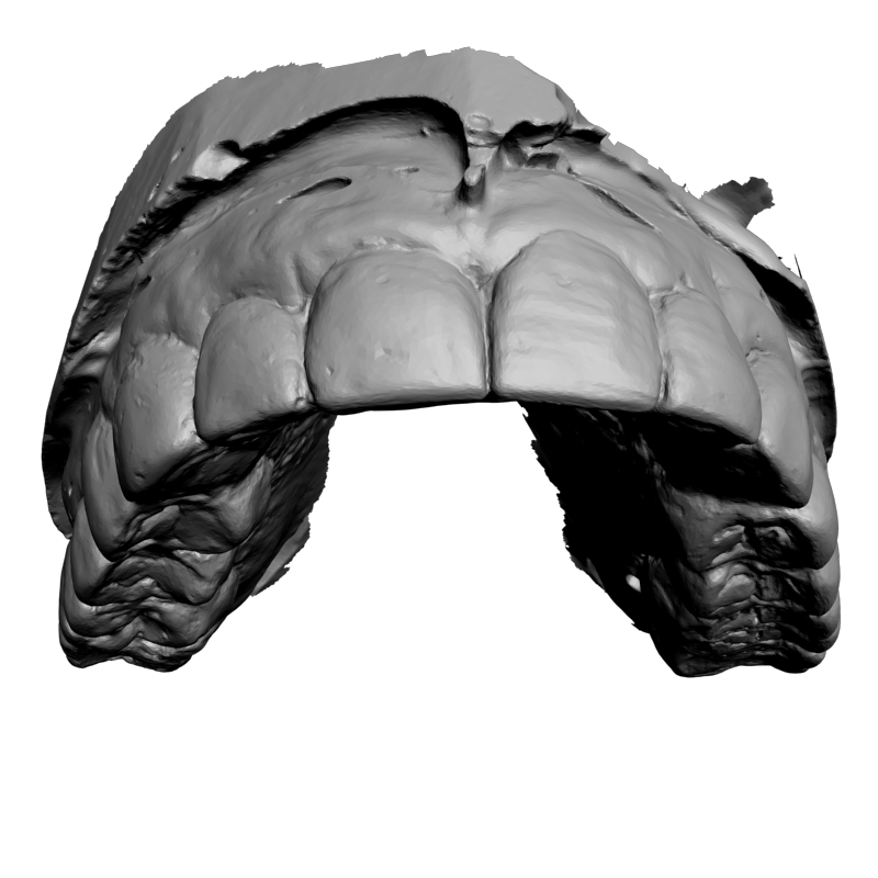 картинка Зубы L5-105 3D-STL.COM