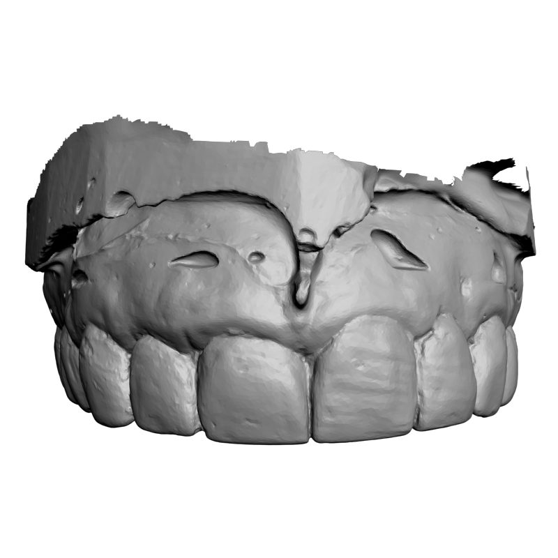 картинка Зубы L5-105 3D-STL.COM