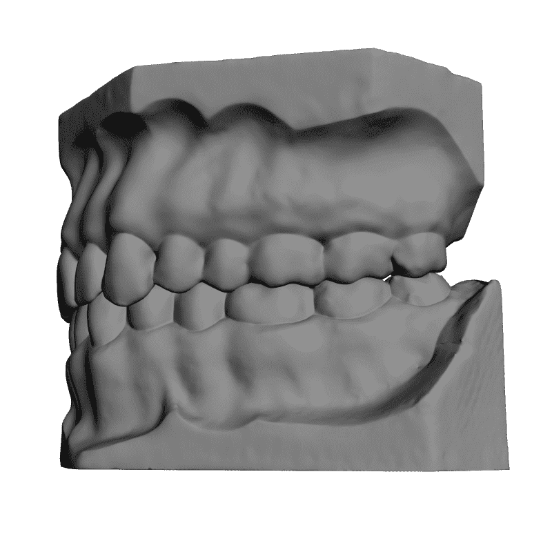 картинка Зубы L5-033 3D-STL.COM